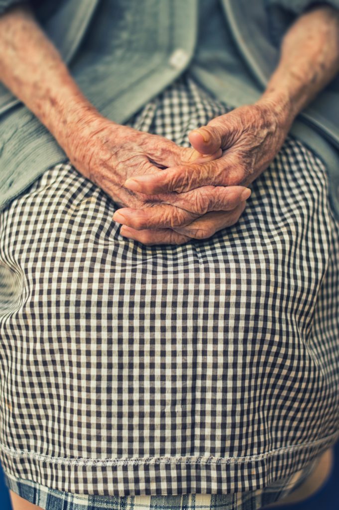 Image of elderly woman's hands with thin skin research into ageing skin