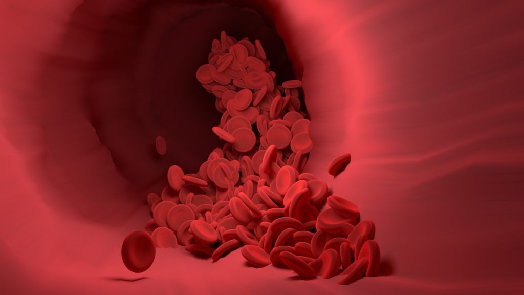 blood clots are a serious cause for concern they put pressure on the brain