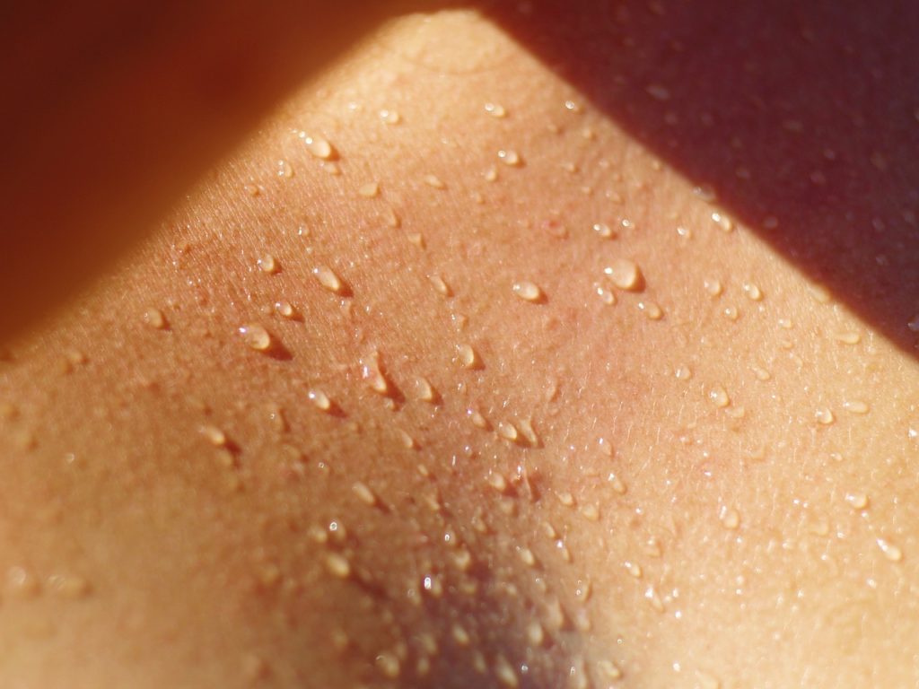 Excessive Sweating is a cause for your concern you should contact your doctor