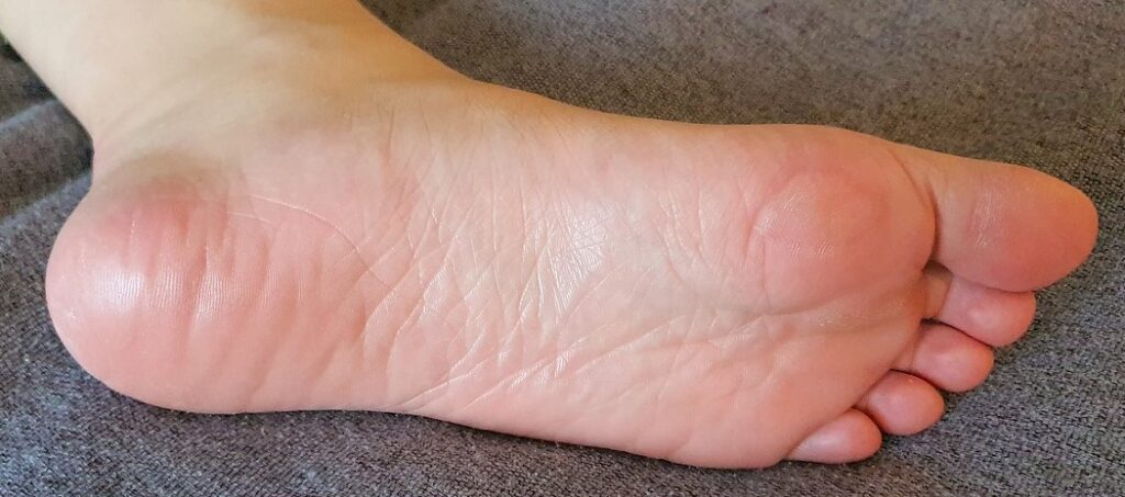 the one place you can lose padding is in your feet. In this case, that’s bad because you need the cushioned layer to protect your tootsies in ageing feet