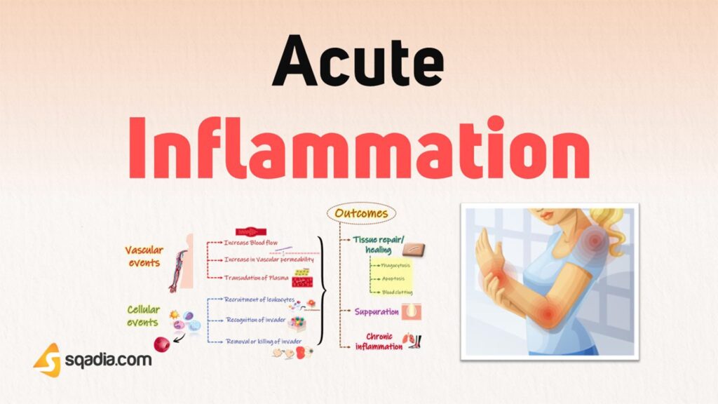 the symptoms of acute inflammation happen When an injury to a specific part of your body occurs