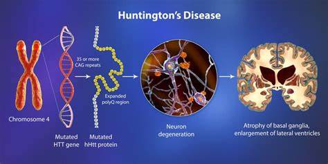 Huntington’s disease is a genetic condition that causes dementia. Two types exist: juvenile and adult onset. 