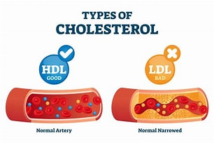 There are studies that show modest improvements of around 20% in cholesterol levels 