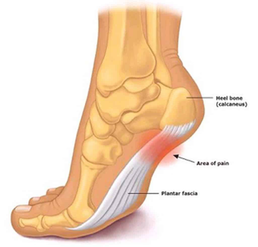 Foot Problems, Besides, one of the most common conditions across all generations is plantar fasciitis, also known as “heel spur syndrome.” 