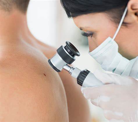 A dermatologist (a doctor who specializes in skin care) can check any unusual spots and teach you what to look for. If they find skin cancer, you’ll need surgery to take out the cancer cells. You also may have radiation or chemotherapy to kill any that are left to keep them from spreading.