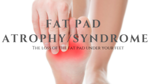 Common in seniors, The fat pad is one of few places in the body where fat is a welcome addition. The foot relies on the fat pad in both the front of the foot and in the heel area to better absorb the tremendous forces the foot is subjected to during the day. 