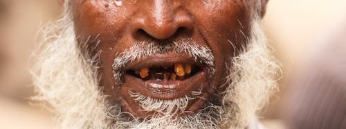 Protecting Your Ageing Teeth. Tooth Loss in Ageing Adults. Infections in the mouth, nose, or sinuses